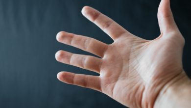 Photo of Sclerodermia
