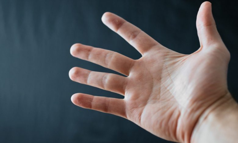 sclerodermia