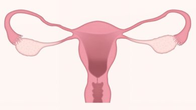 Photo of Cancro alle ovaie, come si cura?