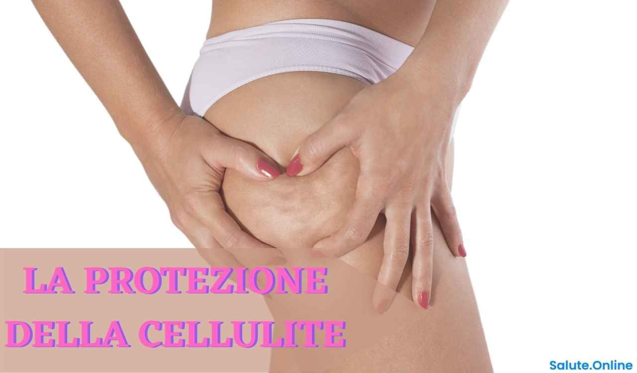 Cellulite