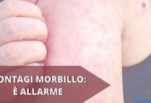 Photo of Morbillo, bambini a rischio contagio: scatta l’allarme