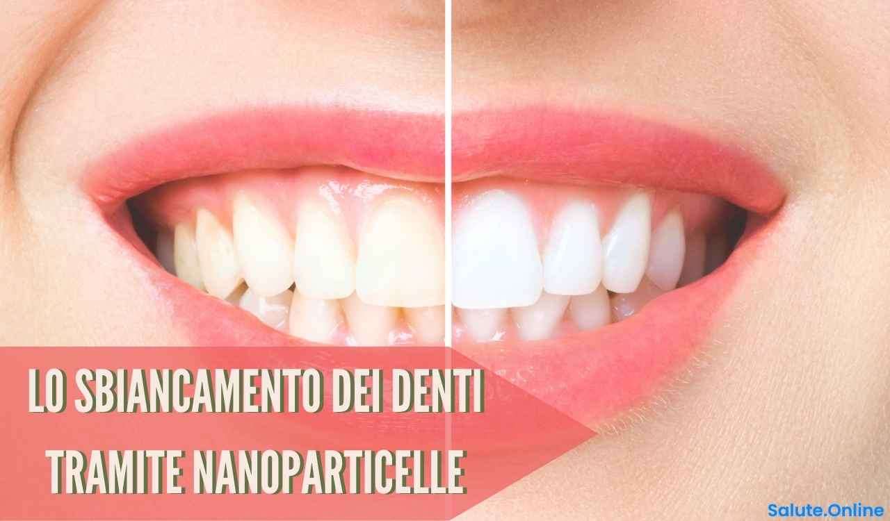 Sbiancamento dei denti