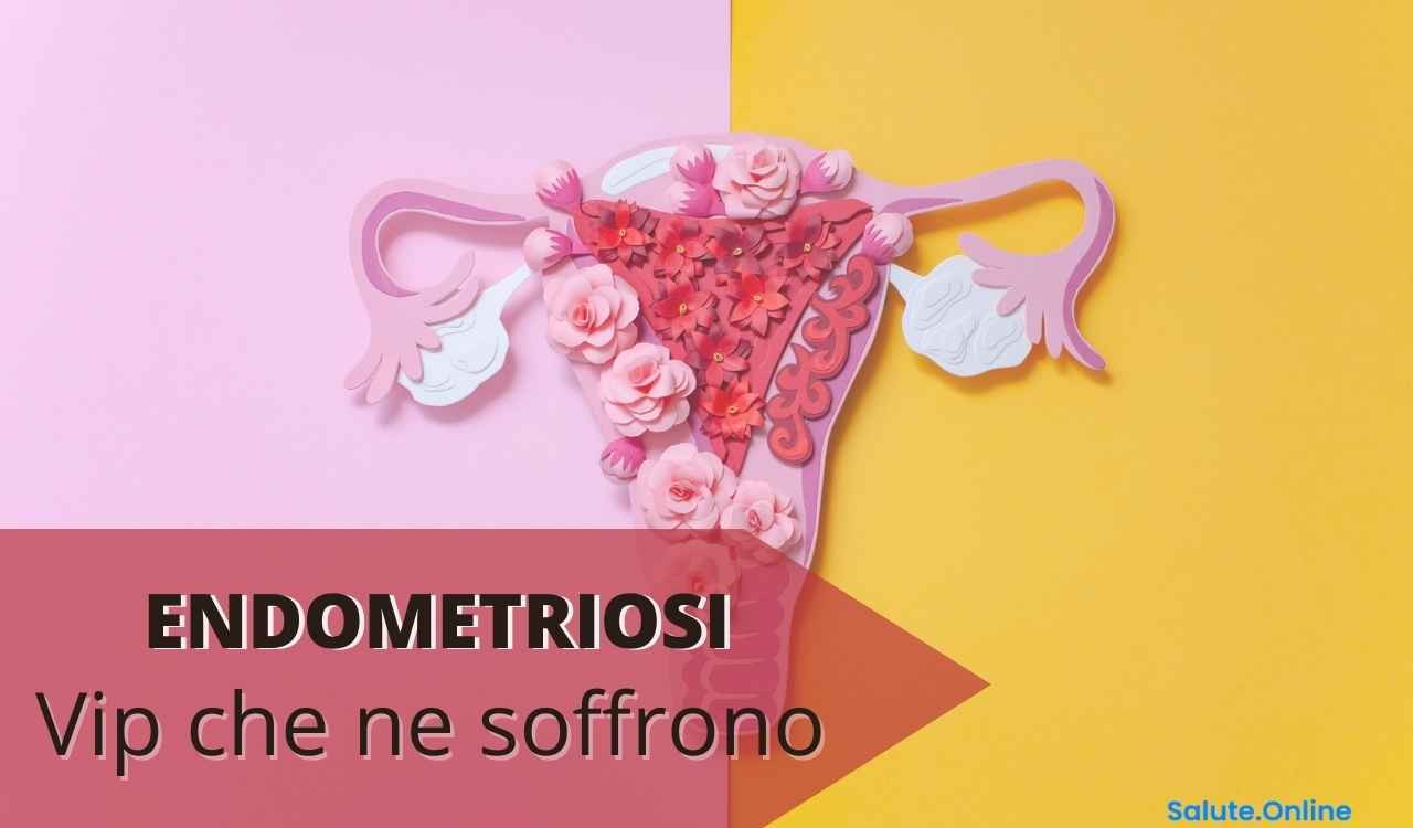 Vip endometriosi