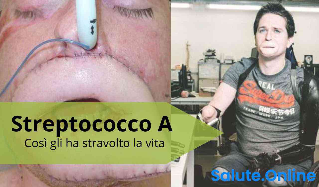 streptococco a infezione